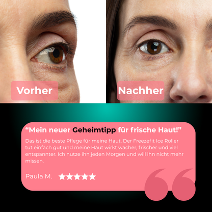 FreezeFit Roller – Dein Eis Spa für zu Hause