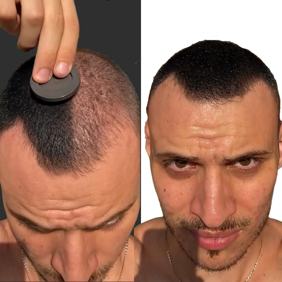 HairLuxe – Sofort volles Haar für lichtes Haar - OddsandEndsBazaar